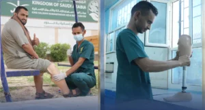 مركز الأطراف الصناعية وإعادة التأهيل في محافظة مأرب - اليمن