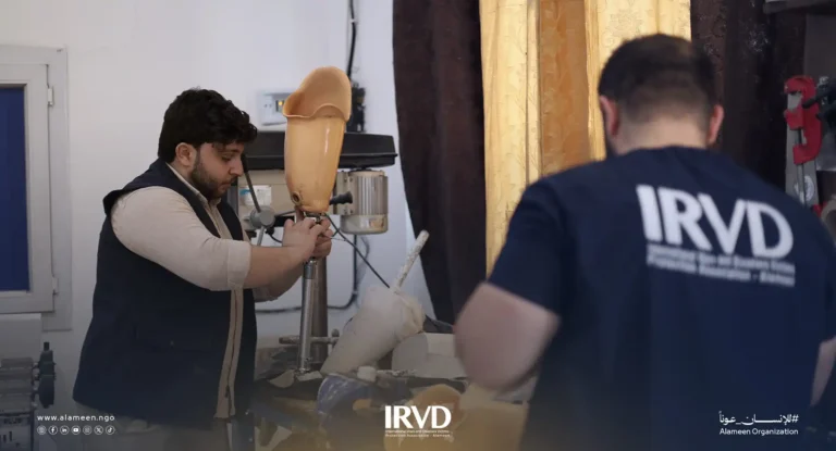 خدمات الأطراف الصناعية وإعادة التأهيل في سرمدا تعيد الأمل للمصابين بالحركة