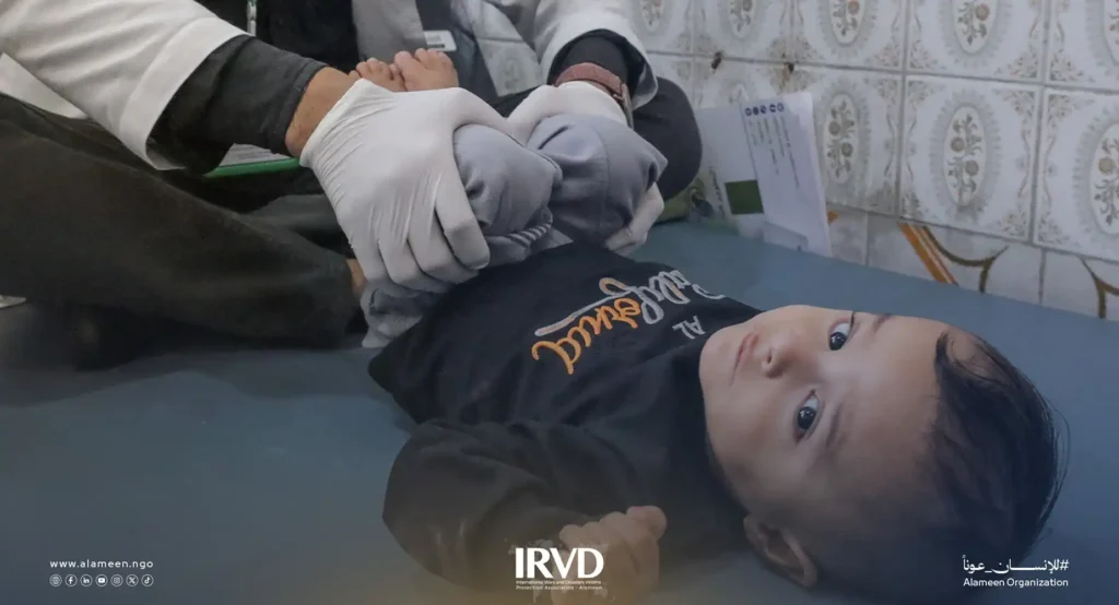 خدمات مركز الأطراف الصناعية وإعادة التأهيل في مدينة تعز – اليمن