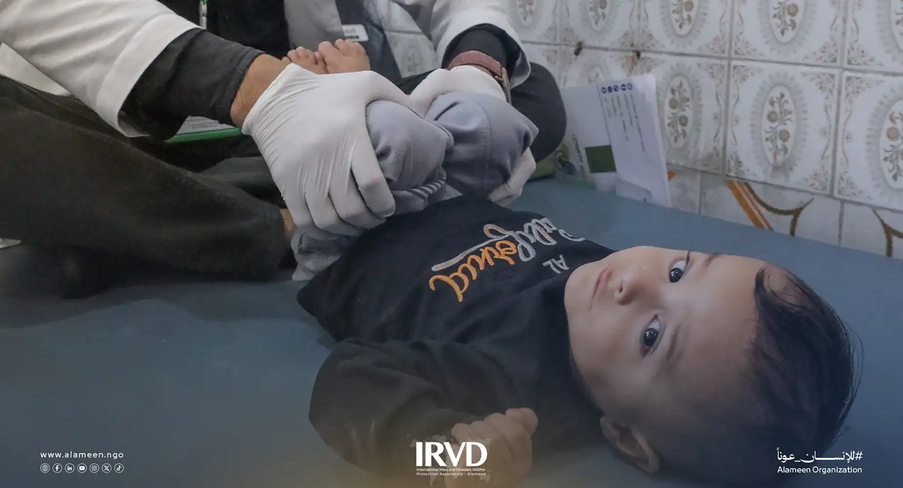 خدمات مركز الأطراف الصناعية وإعادة التأهيل في مدينة تعز – اليمن